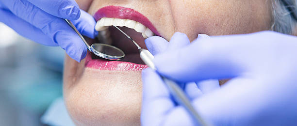Best Emergency Dentist for Lost Fillings or Crowns in Bellmore, NY